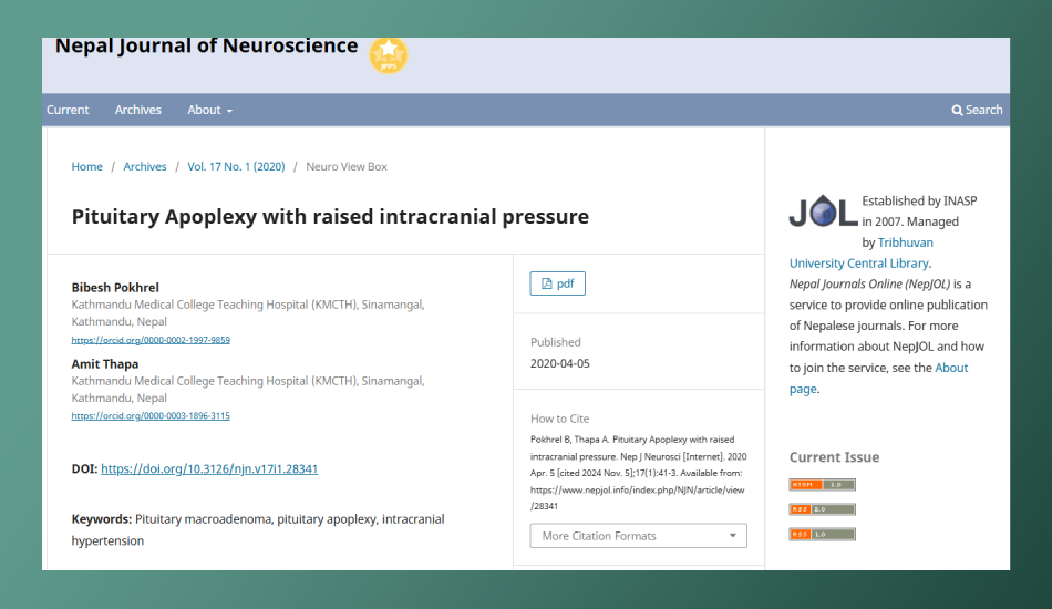 Pituitary Apoplexy with raised intracranial pressure